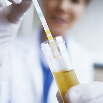 Que montre l'analyse d'urine pour Nechiporenko? Pour déchiffrer l'analyse d'urine par Nechiporenko. Comment prendre l'urine par Nechiporenko